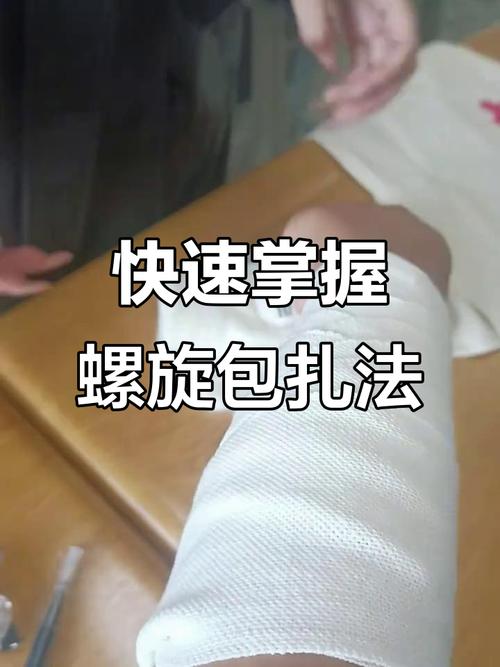 正畸复查时结扎丝如何正确结扎？-图2