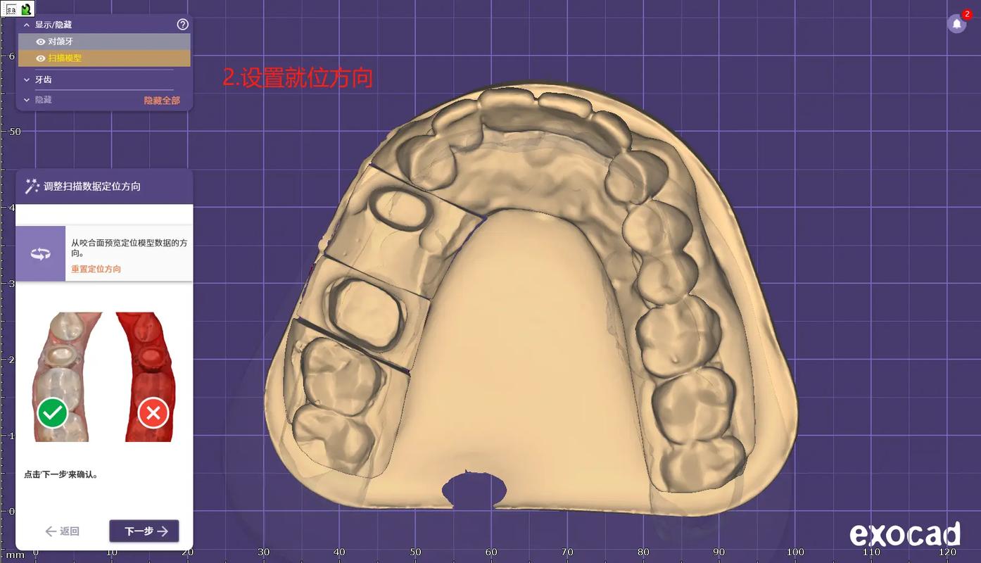 氧化锆牙齿成型有哪些关键技术方法？-图1