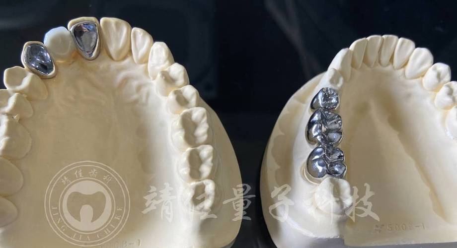 增加桩核固位的方法中-图2