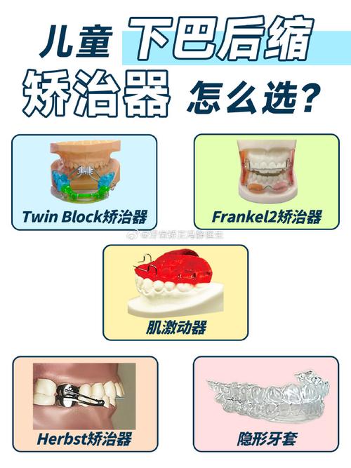 如何正确弯制上颌保持器？关键步骤与临床方法解析-图3