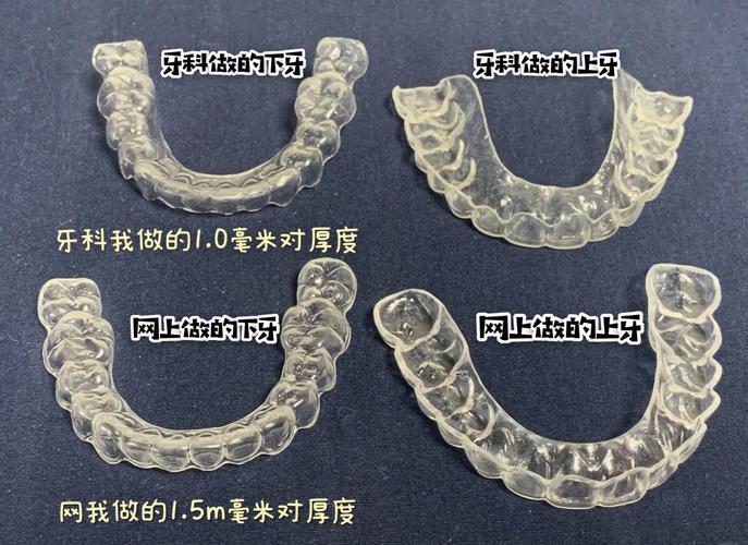 如何正确弯制上颌保持器？关键步骤与临床方法解析-图1
