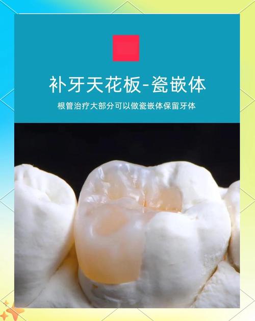 全瓷义齿内冠染色方法如何实现自然美观与持久效果？-图2