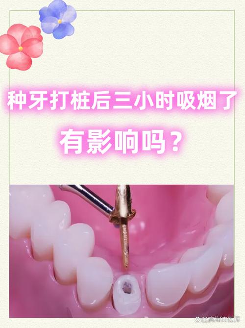 吸烟对种牙影响怀孕吗-图2