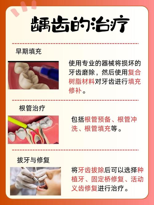 蛀牙牙齿怎么治疗？有哪些有效方法可选？-图1
