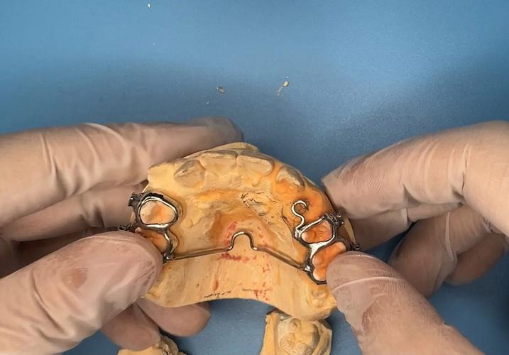 残根正畸牵引如何制作图片？-图2