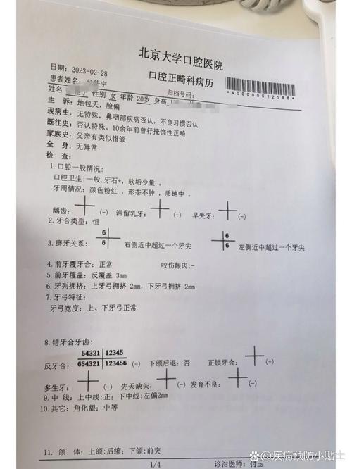 正畸医生说我是复杂病例，复杂究竟在何处？-图1