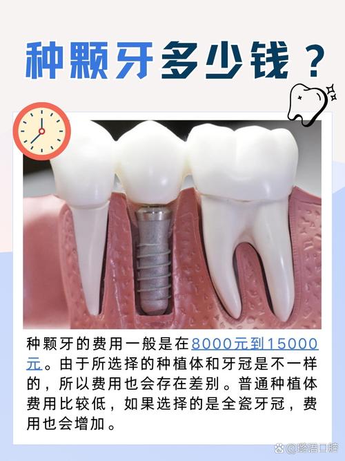 德国种植牙是即时种吗-图1