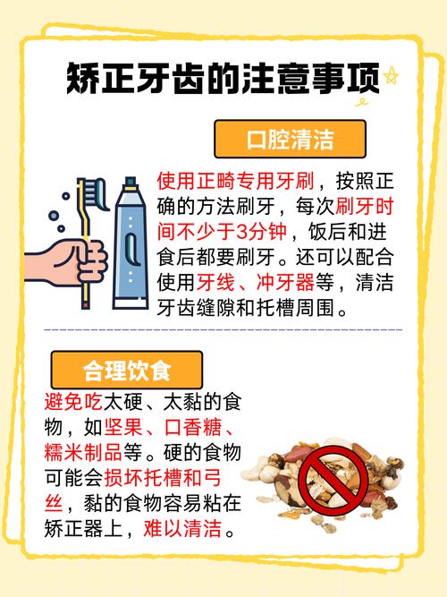 正畸自锁托槽有哪些品牌-图1