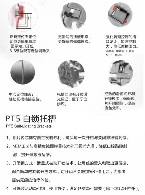 正畸自锁托槽有哪些品牌-图3