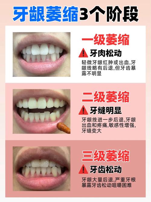 如何通过10种方法科学保养牙齿？关键技巧有哪些？-图2