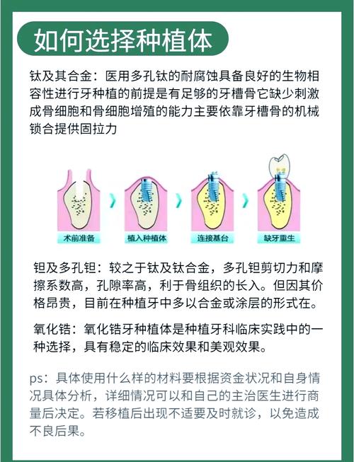 拜博口腔 种植体-图3