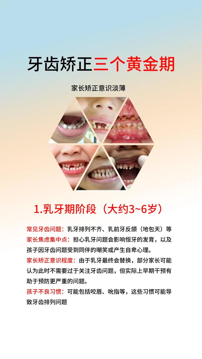 小孩牙不齐矫正何时开始？哪种方法安全有效又适合？-图1