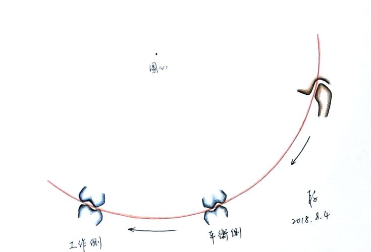 侧方髁导斜度如何计算?关键步骤与影响因素是什么?-图1 侧方髁导斜度如何计算?关键步骤与影响因素是什么?-图1