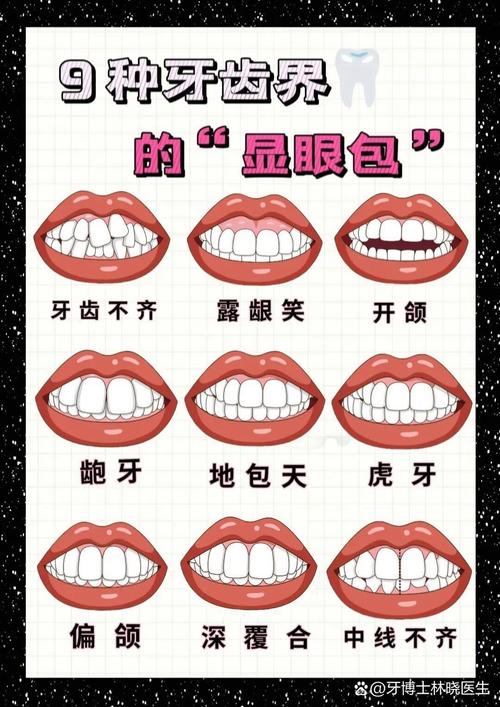 矫正牙齿有几种方法?图解不同矫正方式哪种适合?-图3 矫正牙齿有几种方法?图解不同矫正方式哪种适合?-图3