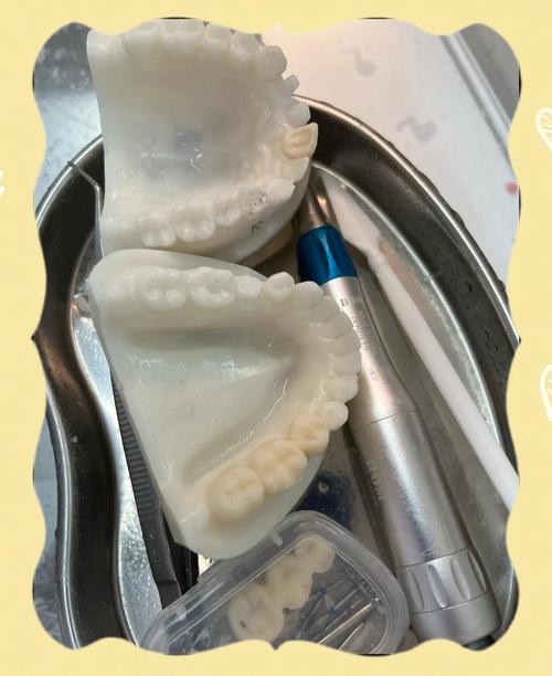 临时冠间接制作方法详解，步骤、材料及注意事项有哪些？-图1