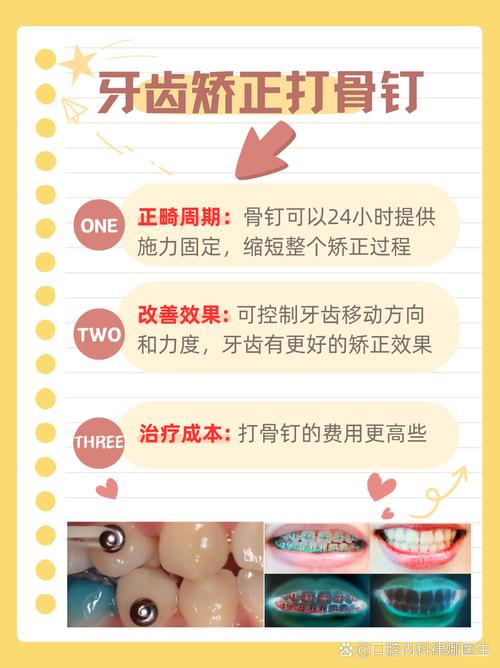 牙齿正畸 不用打钉子吧-图1