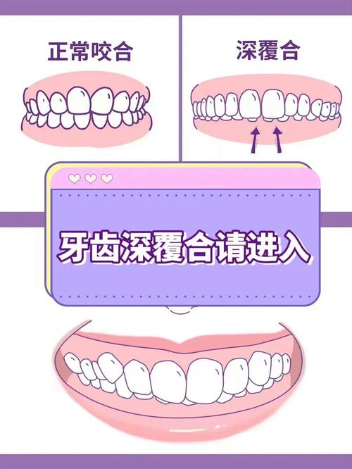把牙齿变尖最快的方法是什么？安全可行吗？-图1