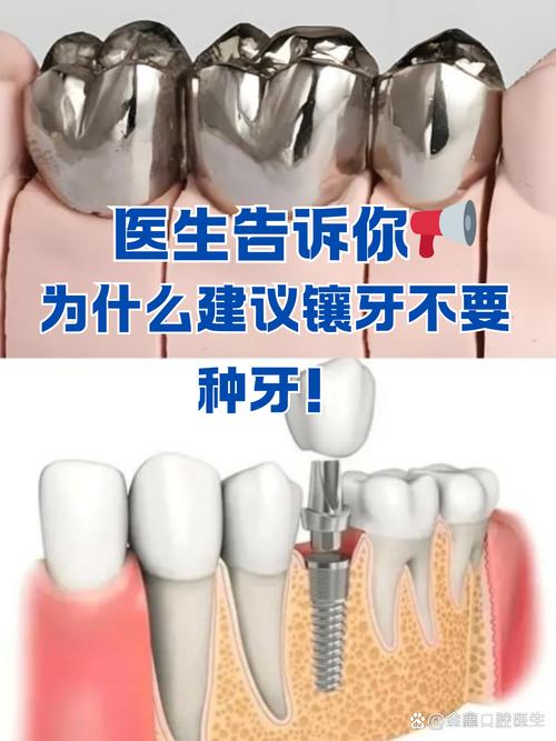 不伤及邻牙的镶牙方法-图2 不伤及邻牙的镶牙方法-图2