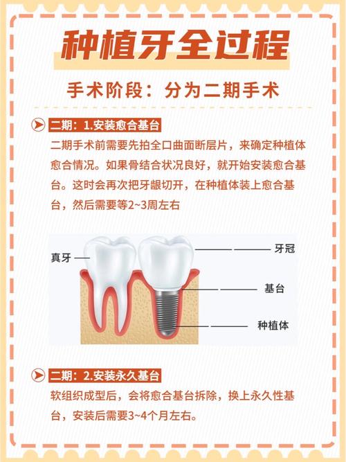 种牙移植牙龈是怎么回事？目的与过程解析？-图3