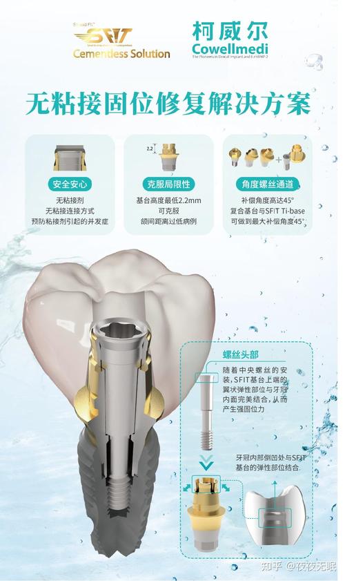 韩国植体品牌种类有哪些?种牙选哪种更合适可靠?-图2 韩国植体品牌种类有哪些?种牙选哪种更合适可靠?-图2