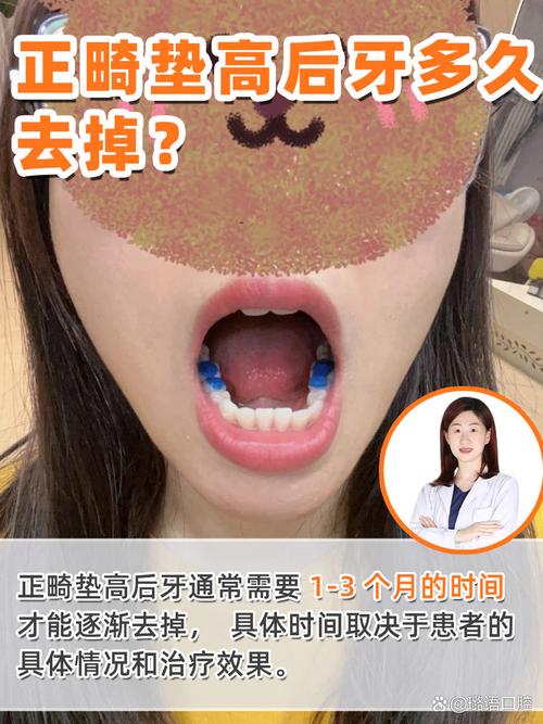 正畸关闭间隙后还要多久完成矫正？-图1