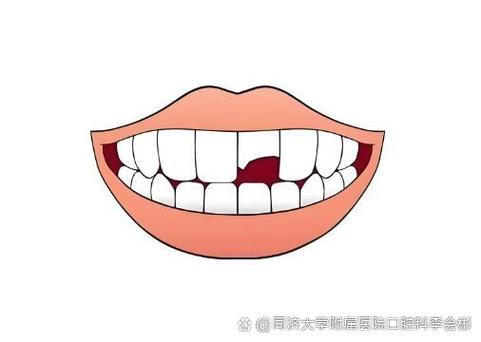 缺失牙咬蜡的正确方法-图3