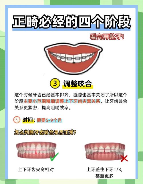 正畸过程的详细步骤讲解-图2