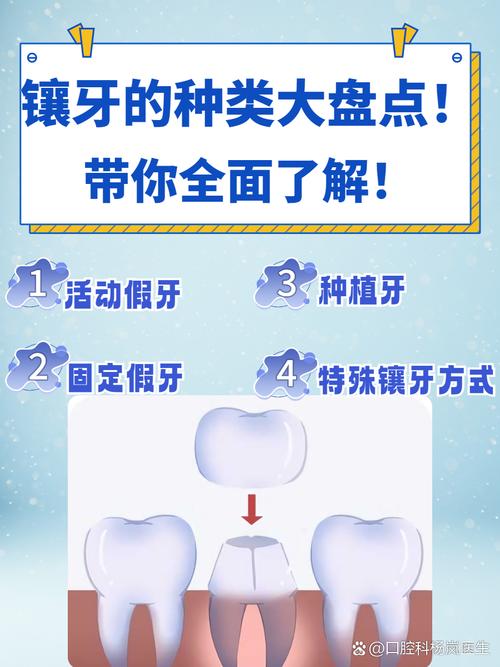 拔牙最迟什么种牙镶牙-图3 拔牙最迟什么种牙镶牙-图3