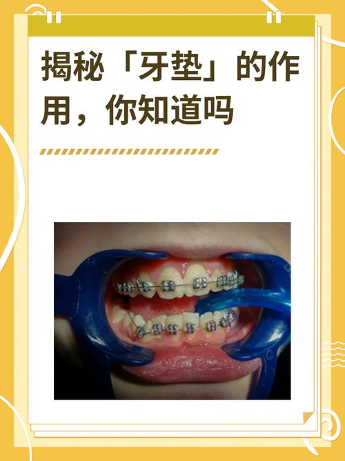 牙齿垫底方法有哪几种-图1 牙齿垫底方法有哪几种-图1