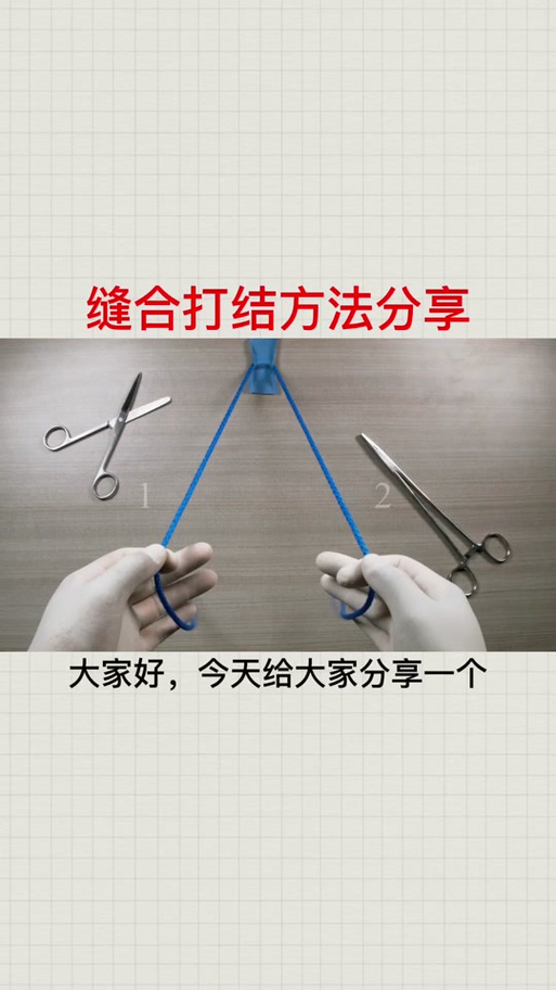 口腔正畸八字结扎方法-图2