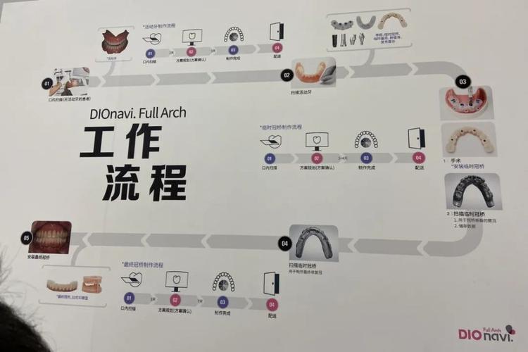 口腔数字化采集的方法有哪些常用技术类型及临床应用特点？-图3