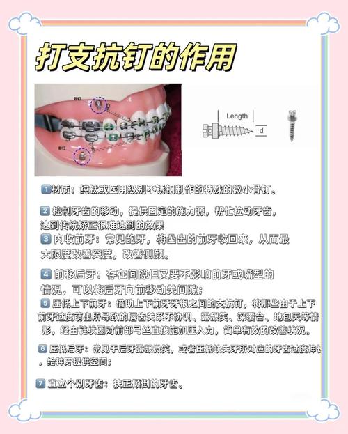 正畸bws弓的功能是什么？作用与应用解析-图1