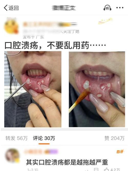大人口腔疾病有哪些治疗方法?如何科学选择与正确护理?-图1 大人口腔疾病有哪些治疗方法?如何科学选择与正确护理?-图1