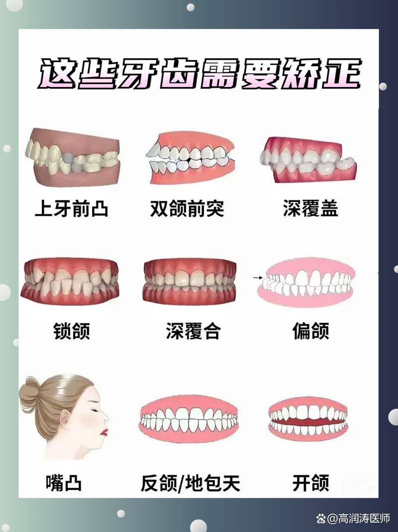 正畸大牙不齐要调整多久-图1