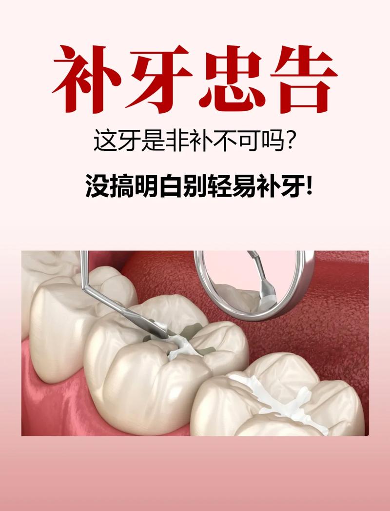 缺前牙补牙最佳方法是什么？前牙修复如何兼顾美观与耐用？-图2
