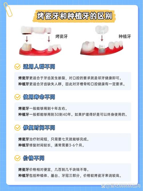 种牙选国产还是进口？两者有何核心区别？-图2