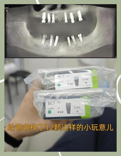 南京数字口腔中心种牙-图2