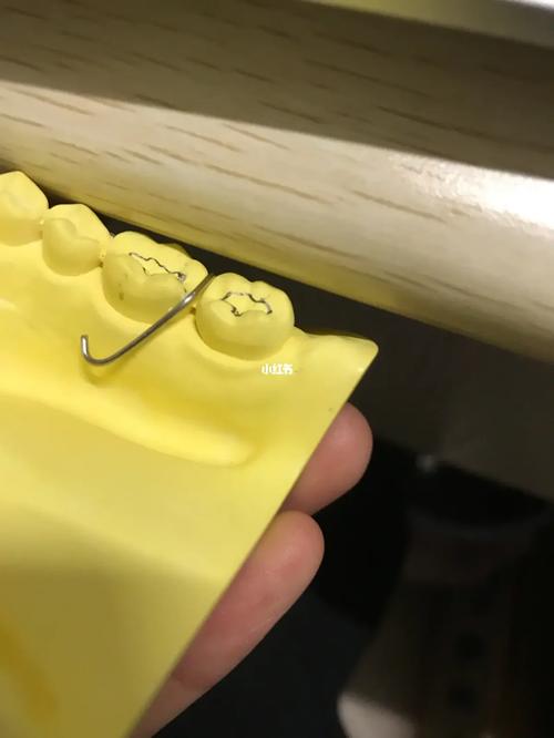 正畸弯单臂卡环教学视频，弯制关键技巧如何快速掌握？-图3