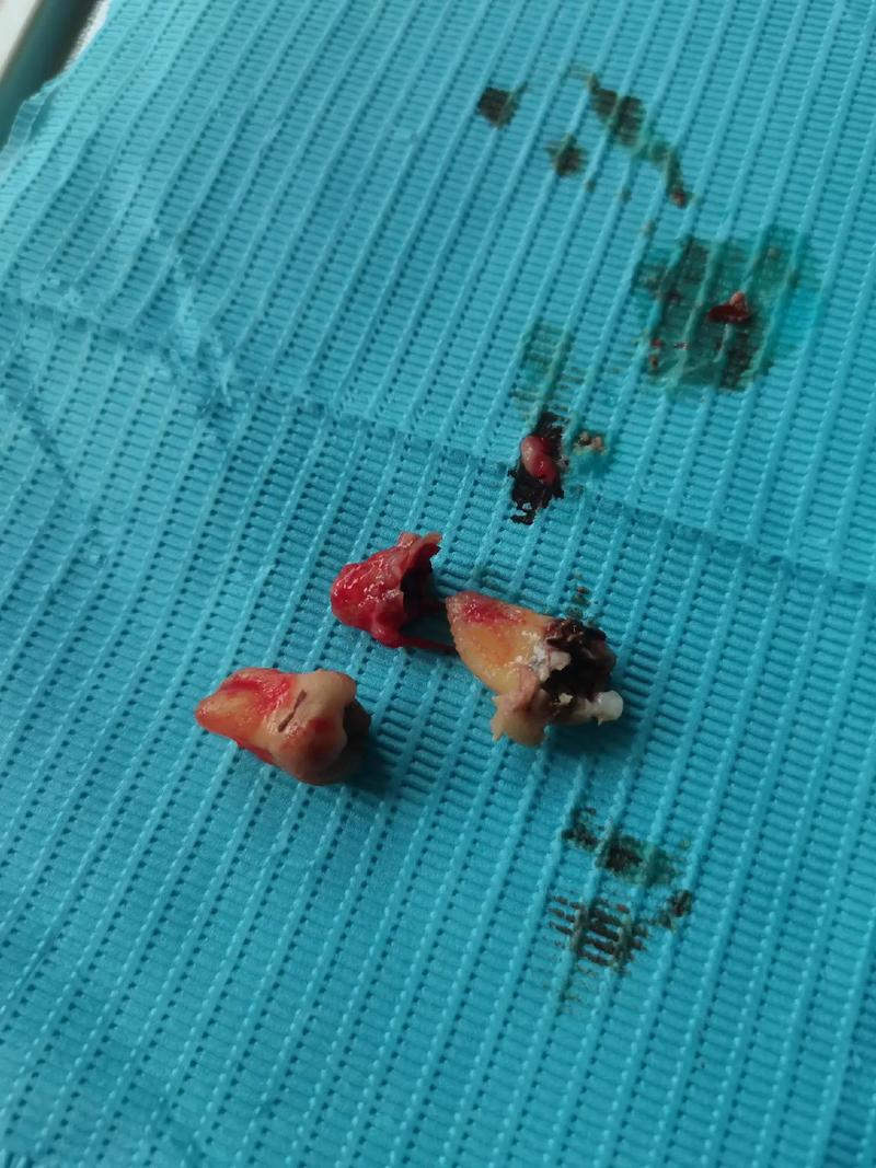 宁波拜博口腔拔牙安全吗?价格怎么样?技术好不好?服务贴心吗?-图3 宁波拜博口腔拔牙安全吗?价格怎么样?技术好不好?服务贴心吗?-图3