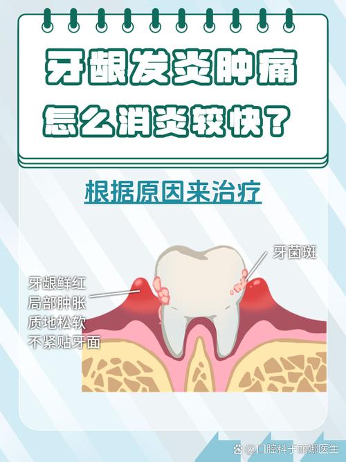 牙龈发炎如何治疗？有哪些有效方法可选？-图2