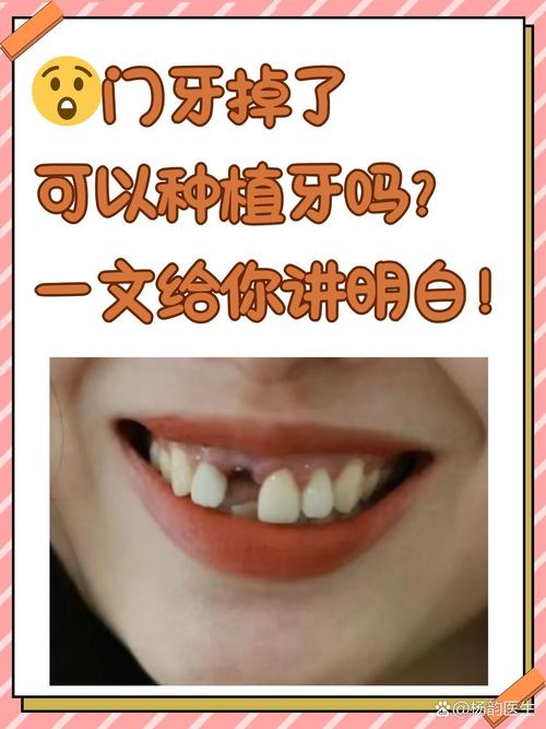 牙齿掉了一半，这种情况是否可以通过种植牙进行修复呢？-图1