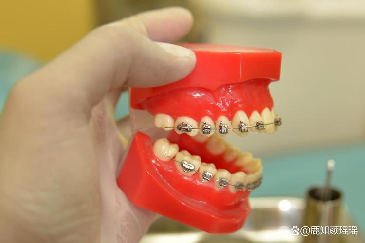 2025广州免费种牙政策真实吗？如何申请？-图3