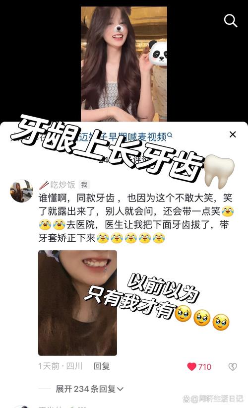 咬合牙长长种牙怎么办-图2