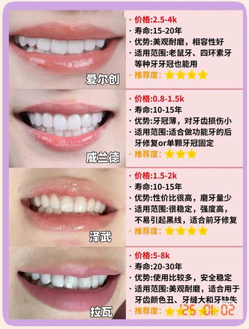 种牙和冠牙哪个更好？不同牙齿缺损情况下的修复方案该如何选择？-图1