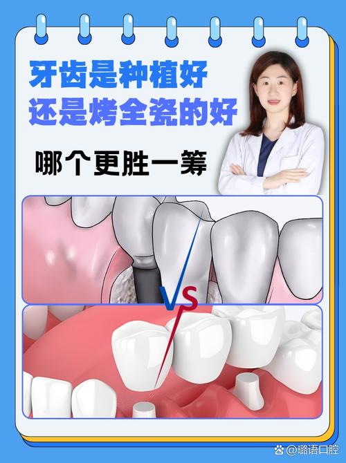 种牙和冠牙哪个更好？不同牙齿缺损情况下的修复方案该如何选择？-图3