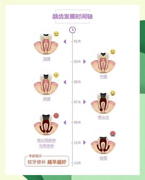 龋齿的病因及预防方法-图3