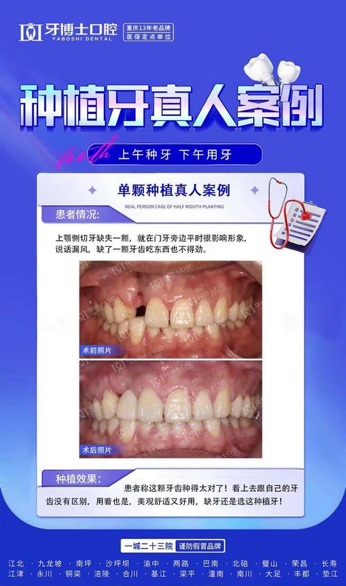 牙博士口腔种牙效果如何？真实口碑与价格怎么样？-图2