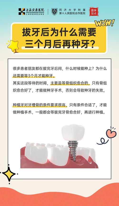 拔牙后能马上种牙吗?即刻种植是否可行?-图1 拔牙后能马上种牙吗?即刻种植是否可行?-图1