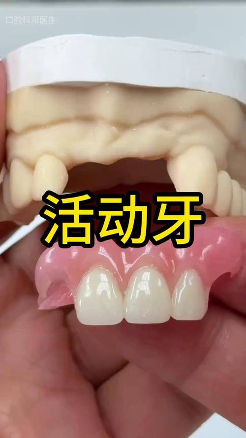 种牙手术后旁边牙活动，是何原因？-图2