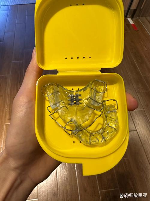 正畸塑料弹力部件那个到底叫什么名字？-图1